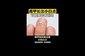 指甲有小小的白点，到底要不要看医生，十几秒就告诉你👍#医学科普 #涨知识 视频封面