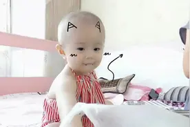 单眼皮变双眼皮，会遗传吗？