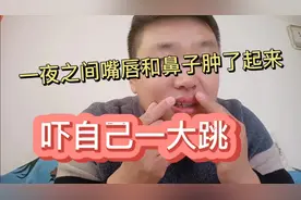 今天早上起来嘴唇突然肿了不知所措了想请大家给个好建议怎么办视频封面