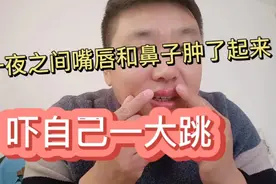 今天早上起来嘴唇突然肿了不知所措了想请大家给个好建议怎么办视频封面