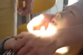 为什么现在的孩子牙齿多不是自动掉，看儿子拔牙的过程看着都心疼