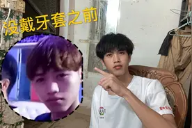 带牙套会有后遗症吗？带你了解带牙套的坏处与好处视频封面