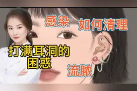 医学演绎 人体耳朵打耳钉 穿耳洞 容易感染 如何定期清除脓液视频封面