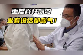 重度脊柱侧弯93度，腰上长毛是里面出现问题？能否手术还成了疑问视频封面
