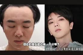 华晨宇被爆整容植发，前女友发视频称张碧晨是小三，本人暂未回应视频封面