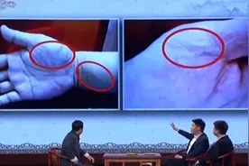 看中医，如何通过手诊来判断脾胃病，赶紧来试试吧视频封面