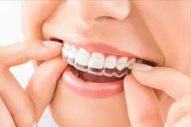 儿童矫正牙齿最佳时间是什么时候？医生：分情况视频封面