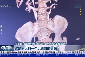 女子天生四个肾，竟全部长结石，医生提醒：一定要及时医治！视频封面