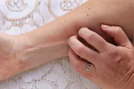 血燥热引起皮肤瘙痒、起红疙瘩，这是怎么了？该怎么办呢？视频封面