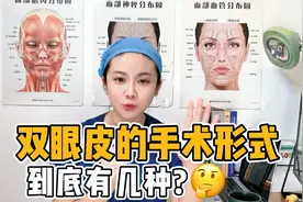 双眼皮手术到底有几种，三甲整形医生告诉你！看完不要再被骗啦！视频封面
