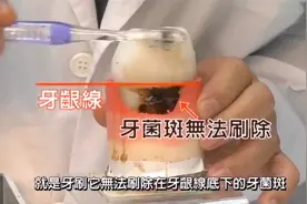 刷牙也不能刷掉的牙菌斑，要怎么弄？冲牙器一冲即灭！视频封面