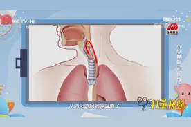 睡觉憋醒、呼吸困难，竟然是胃食管反流病，饮食要注意|健康之路