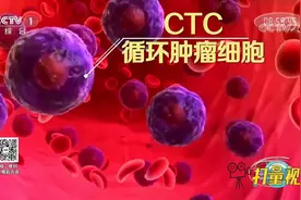医疗新技术！CTC纳米检测技术，致力于发现早期肿瘤细胞|生活圈视频封面