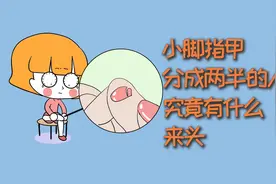 小脚趾甲分成两半的人，究竟有什么来头？视频封面