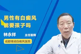 男性患上白癜风，能要孩子吗？会不会遗传给下一代？
