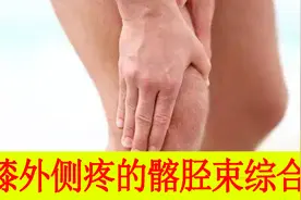 膝关节外侧一点疼痛，了解一下很容易被误诊的髂胫束综合征视频封面