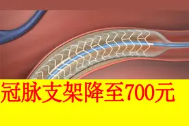 冠心病患者迎来好消息，冠脉支架降至700元左右！视频封面
