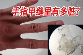 手指甲缝里有多脏？1000倍放大看完就懂得洗手了视频封面