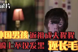 外国男孩返祖成大猩猩，脸上发黑还长毛，他却把过错归咎于同学！视频封面