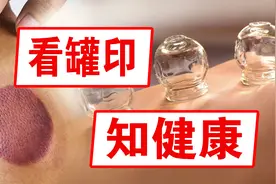 拔罐拔出深黑色的是毒素吗？不同的颜色，代表不同的身体情况视频封面
