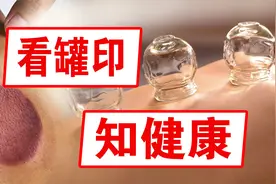 拔罐拔出深黑色的是毒素吗？不同的颜色，代表不同的身体情况视频封面
