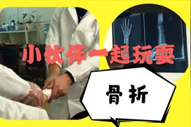 小男孩和伙伴玩耍，被推倒骨折，如果你是孩子家长这种情况怎么办