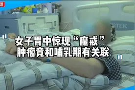 二胎妈妈胃部长期不适，竟是癌变信号？医生：孕期哺乳期女性高发视频封面