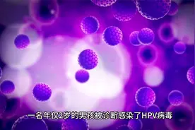 男童喉咙长菜花样肿块确诊感染HPV视频封面