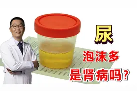 尿里泡沫多，是不是有肾病？医生总结：分为2种情况，不都是病！视频封面