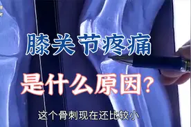 膝关节疼痛并非骨关节炎引起的，那疼痛原因是什么？视频封面