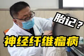 小女孩身上长满了胎记？这种咖啡斑不简单，听听外科医生怎么说视频封面