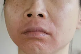 实话实说：嘴唇“发黑”，说明身体可能出现5种情况，要及时调理