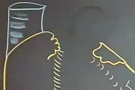 01斯坦福大学公开课：临床解剖学 人类心脏解剖图视频封面