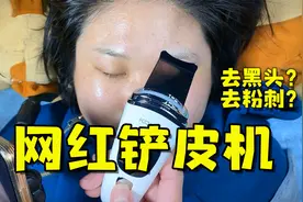测评网上最近很火的“铲皮机”，用它就能把黑头轻松铲掉？视频封面