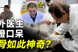 65岁老中医正骨现场，不用开刀一拉就好，老外医生看得目瞪口呆！视频封面
