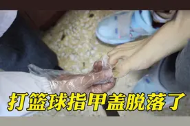 男子打篮球指甲盖和肉分离了，医生：没大问题，会长出新的指甲视频封面