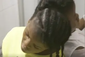 连体人当中一个吃饭，另一个会饿死吗，看完长知识了视频封面