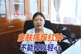 得了带状疱疹，皮肤会有4个明显表现，医生：不就医会“痛死”视频封面