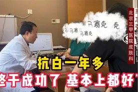 发现一年多，基本痊愈了，白癜风不是治不好，就怕你拖着不治视频封面