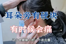 耳朵旁有硬物，有时候会痛，可能是腮腺混合瘤！视频封面