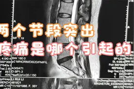 本周二（9月6号）上午须水镇卫生院坐诊！视频封面