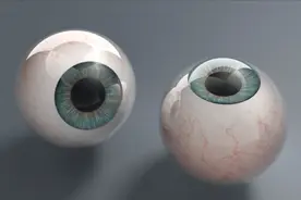 眼科主任为您科普：关于玻璃体混浊的全面解读视频封面