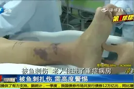 小伤别忽视！漳州阿婆被鱼刺伤变成败血症，医生：死亡率达75%视频封面