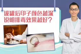 拔罐后印子颜色越深，说明排毒效果越好？中医教你看懂罐印