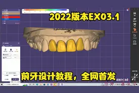 前牙设计教程，全网首发教程EXO3.1版本教程视频封面