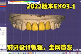 前牙设计教程，全网首发教程EXO3.1版本教程视频封面