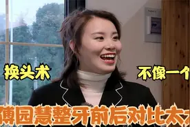 有种“整容”叫傅园慧，整牙后完全判若两人，这下终于相信baby了视频封面