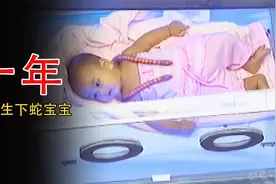 怀孕十年却意外生下蛇宝宝，结果导致自己被送进精神病医院视频封面