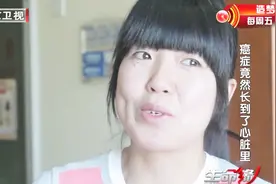 生命缘：家人坚决不放弃，医生进行会诊，手术难度极大视频封面
