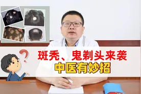 斑秃、鬼剃头来袭 中医有妙招视频封面